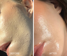 Load image into Gallery viewer, Glass Skin Liquid Exfoliant