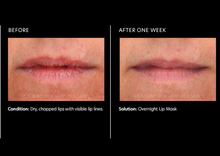 Load image into Gallery viewer, Hyaluronic Acid Lip Booster