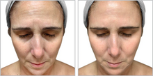 Load image into Gallery viewer, FF3 Triple Repair Complex
